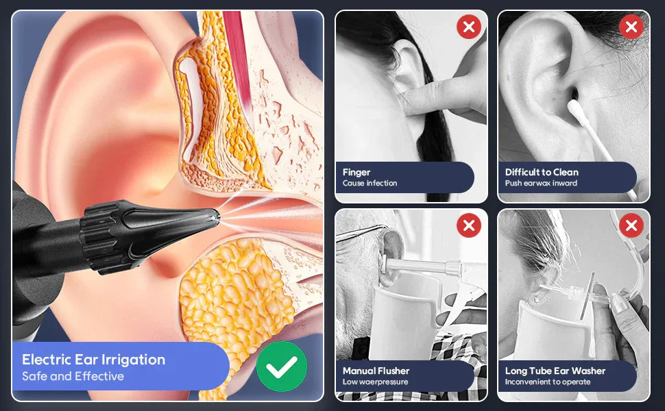 Electric Ear Wash – Convenient Household Cleaning Tool for Safe and Effective Ear Care - Wayn Shopping