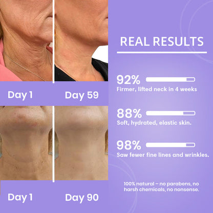 Before and after results of a skincare product on neck skin with text highlighting improvements.